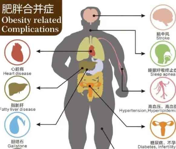 肥胖的八大危害图