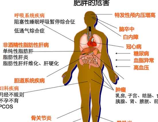 肥胖的危害有哪些癌症