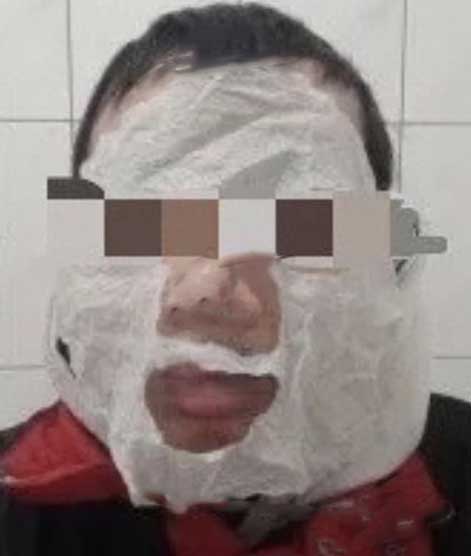 台外卖员竟靠贴面膜扫脸盗号抢单，骗走上万元？