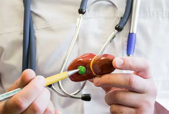 结石变癌不是危言！2个高危饮食快戒掉