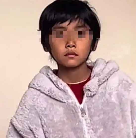 男孩发烧10余小时退烧脸变黑？家长必看真相