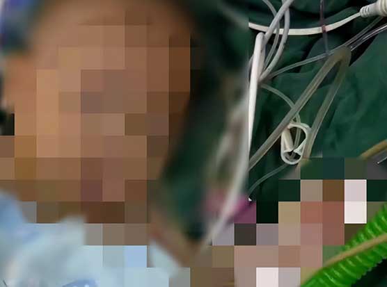 宁波患儿术后离世通报：院长等多人被严肃处理