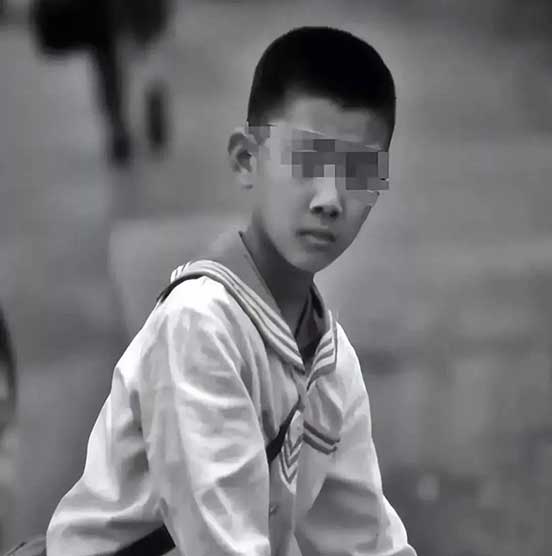 哥哥安抚腮腺炎弟弟，得知传染瞬间变脸太真实