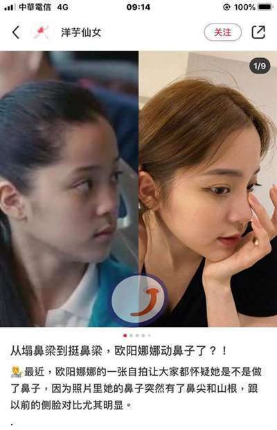 欧阳娜娜鼻梁被指整容 欧阳妮妮：你们真厉害